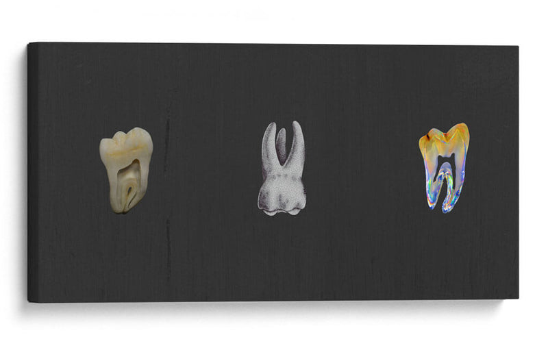 Molares - Odontograma Mx | Cuadro decorativo de Canvas Lab