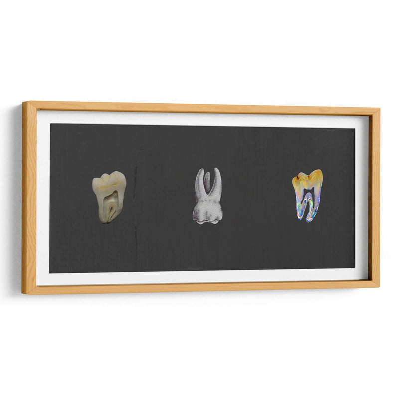 Molares - Odontograma Mx | Cuadro decorativo de Canvas Lab