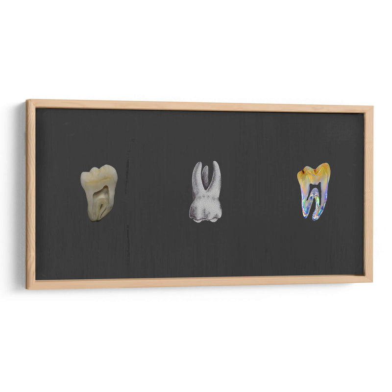 Molares - Odontograma Mx | Cuadro decorativo de Canvas Lab