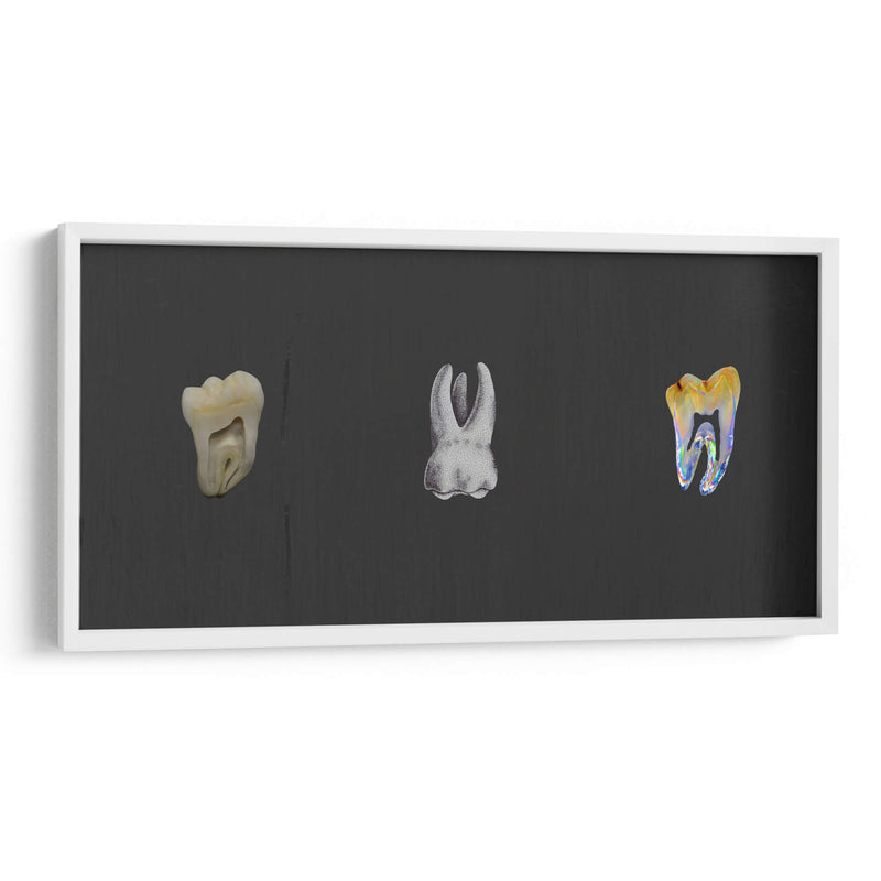 Molares - Odontograma Mx | Cuadro decorativo de Canvas Lab