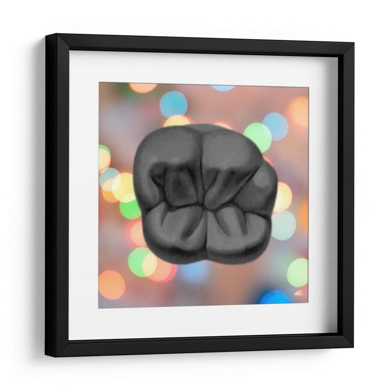 Oclusal - Odontograma Mx | Cuadro decorativo de Canvas Lab