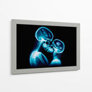 Radiografía del amor - Paltik Arte Digital | Cuadro decorativo de Canvas Lab