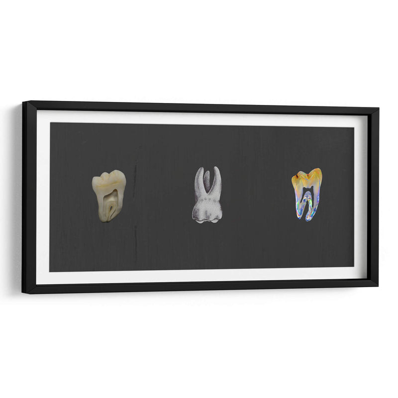 Molares - Odontograma Mx | Cuadro decorativo de Canvas Lab