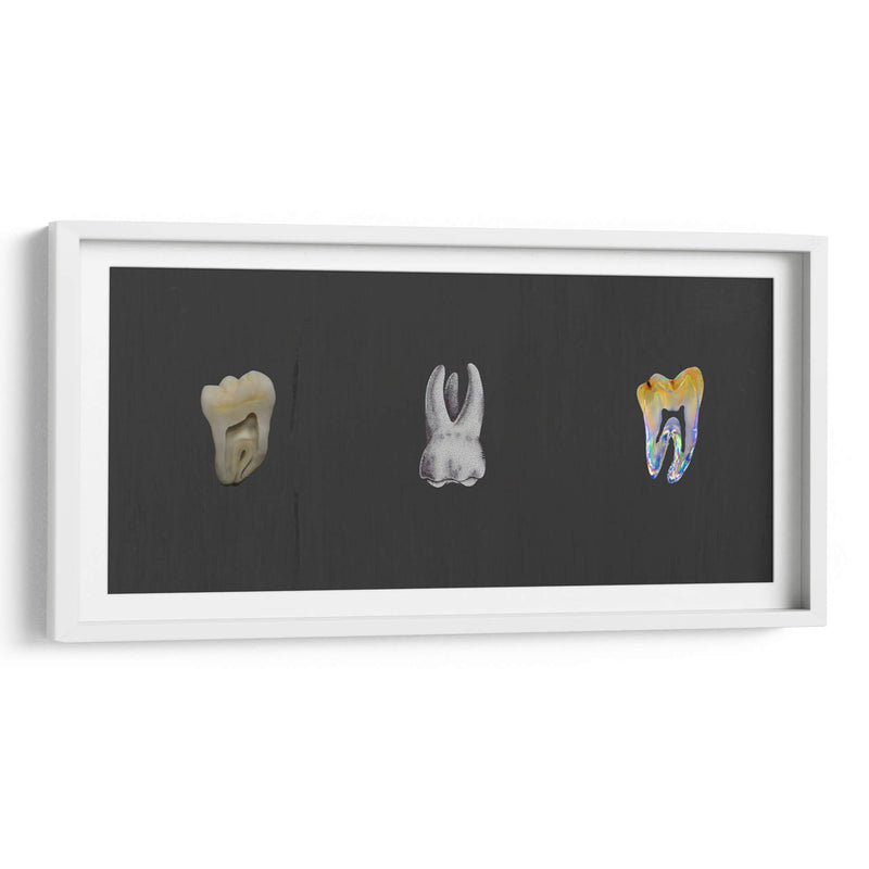 Molares - Odontograma Mx | Cuadro decorativo de Canvas Lab